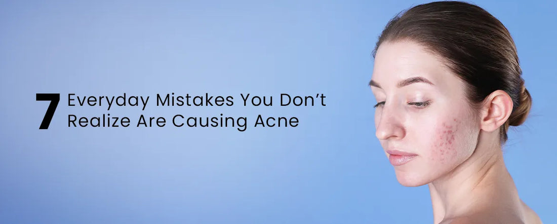 7 Everyday Mistakes You Don’t Realize Are Causing Acne
