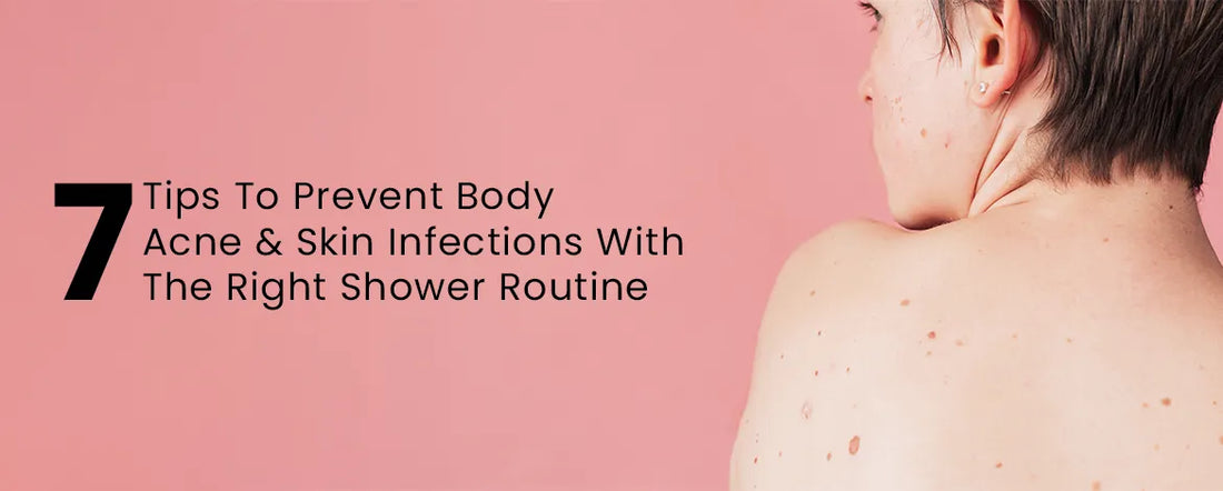 7 Tips To Prevent Body Acne & Skin Infections With The Right Shower Routine
