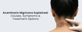 Acanthosis Nigricans Explained: Causes, Symptoms & Treatment Options