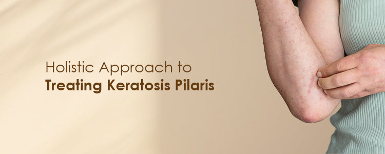 Holistic Approach to Treating Keratosis Pilaris