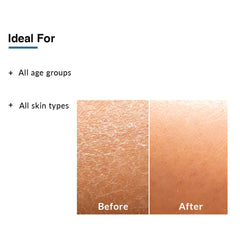 Before & after using Fixderma Moisturizing Lotion