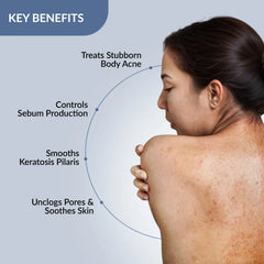 Salyzap-AZ Body Spray