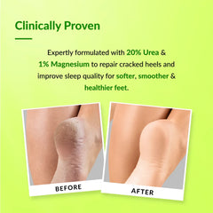 Foobetik Foot Cream Roll On