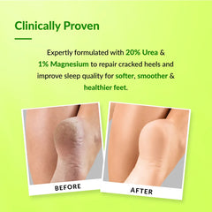 Foobetik Foot Cream Roll On