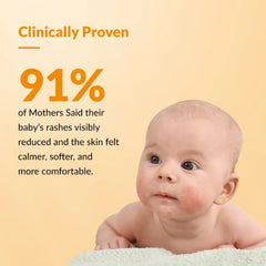 Hoopoe Anti Rash Face Cream