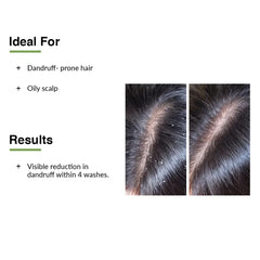 Kairfoll Anti Dandruff Shampoo