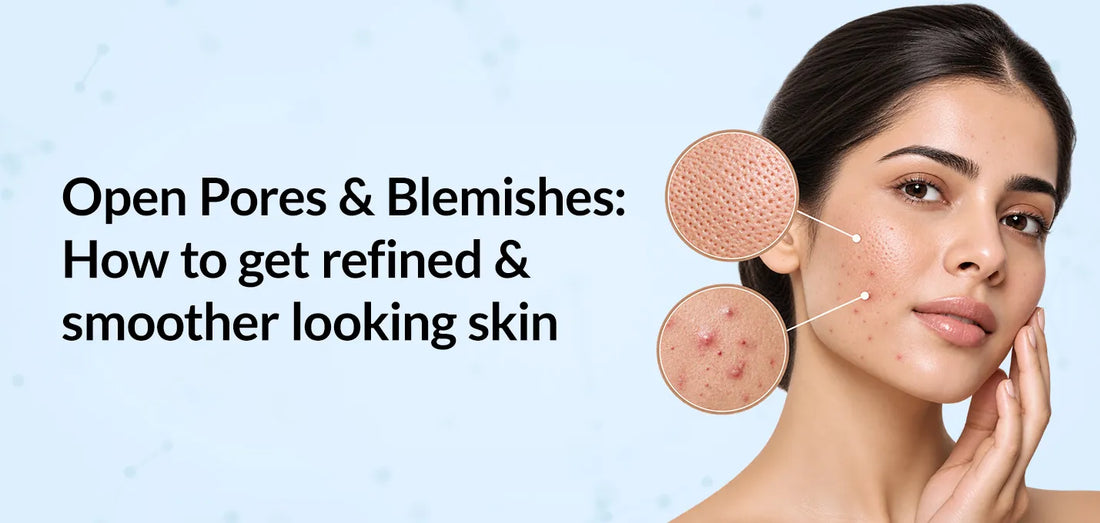 Open Pores & Blemishes: How to get refined & smoother looking skin