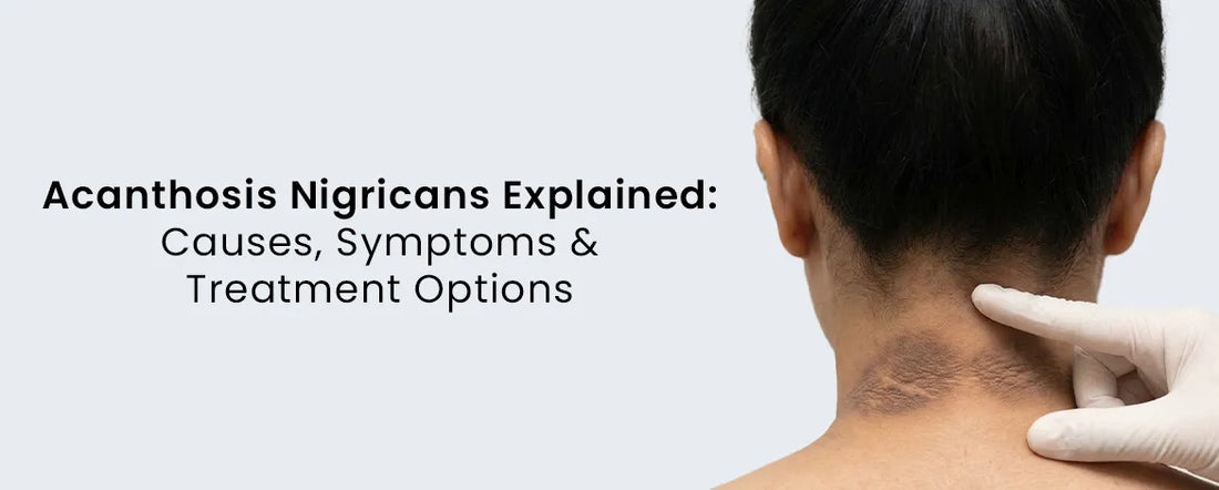 Acanthosis Nigricans Explained: Causes, Symptoms & Treatment Options