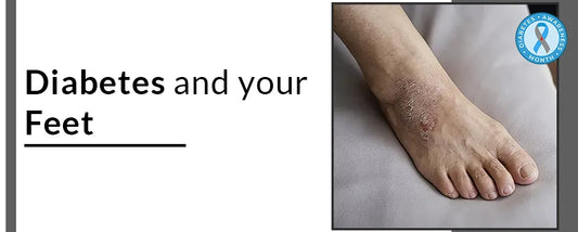 Can diabetes cause problems in your feet-skin?