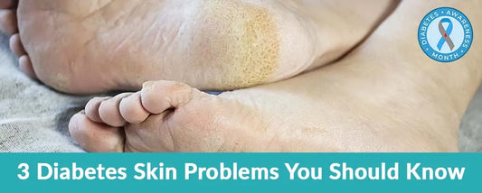 Skin problems which diabetes can give you