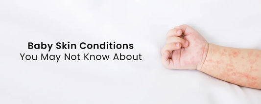 Baby Skin Conditions You May Not Know About