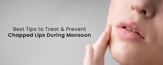 Best Tips to Treat & Prevent Chapped Lips During Monsoon