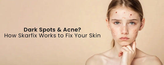 Dark Spots & Acne