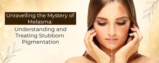 Unravelling the Mystery of Melasma: Understanding and Treating Stubborn Pigmentation