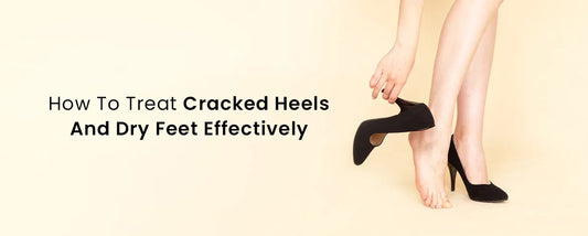 How To Treat Cracked Heels And Dry Feet Effectively