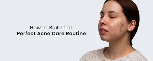 How to Build the Perfect Acne Care Routine