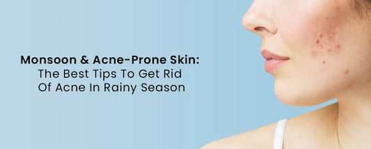 Monsoon & Acne-Prone Skin: The Best Tips To Get Rid Of Acne In Rainy Season