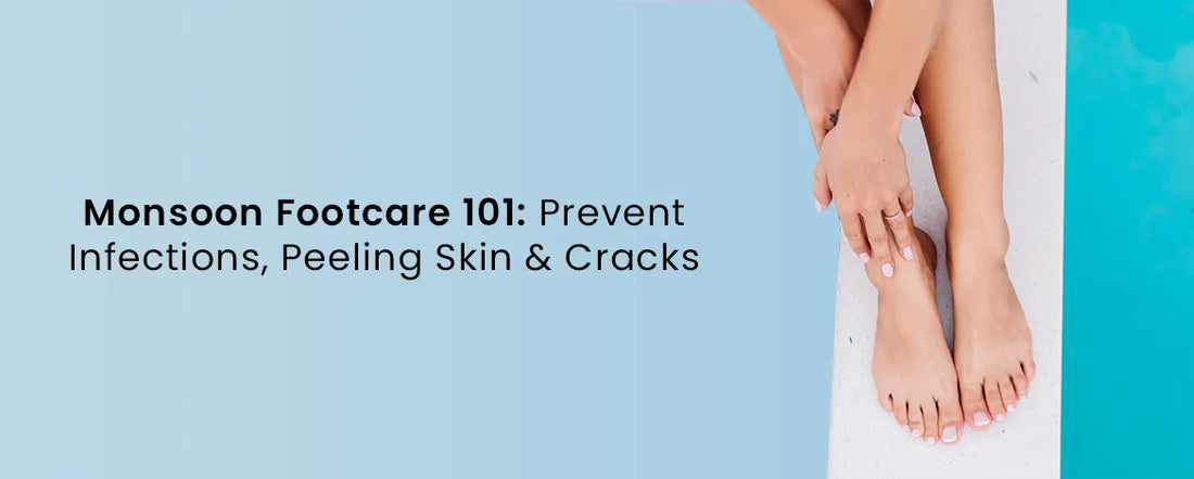 Monsoon Footcare 101: Prevent Infections, Peeling Skin & Cracks