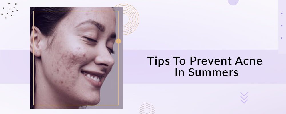 How can you prevent acne during the summer?