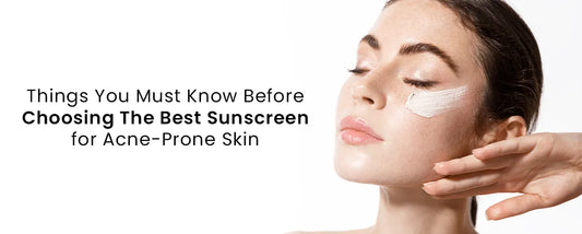 Things You Must Know Before Choosing The Best Sunscreen for Acne-Prone Skin
