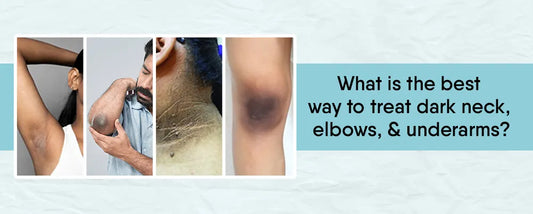 best way to treat dark neck, elbows, and underarms