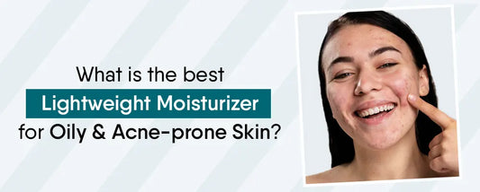 best lightweight moisturizer for oily and acne-prone skin