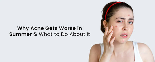 Why Acne Gets Worse in Summer & What to Do About It