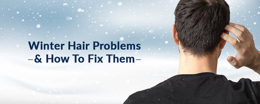 Common Winter Hair Problems & How to Fix Them
