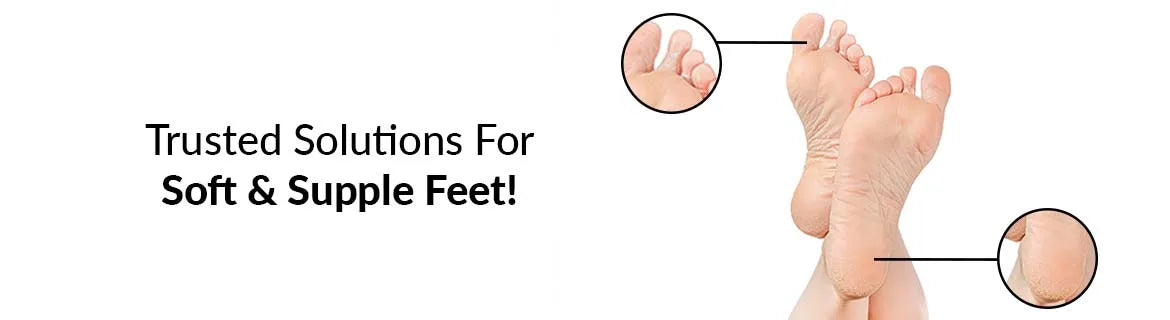 Cracked Heels Treatment - Cream for Cracked Heels
