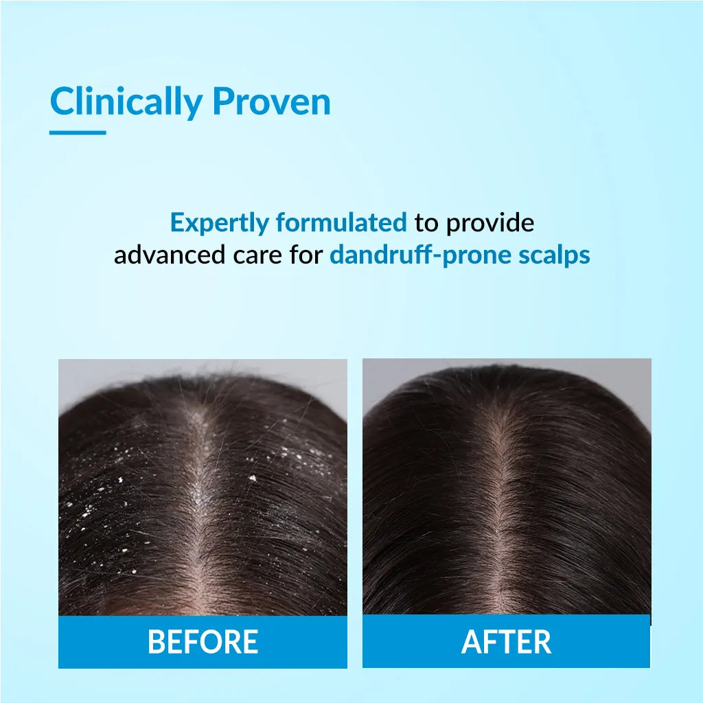 Bioteez Advance Shampoo