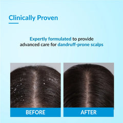 Bioteez Advance Shampoo