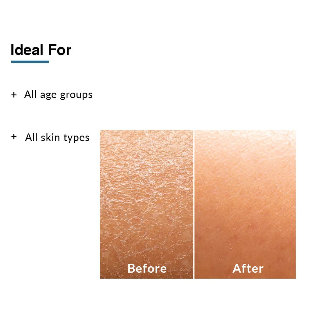 Before & after using Fixderma Moisturizing Lotion