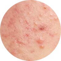 Fixderma Skincare