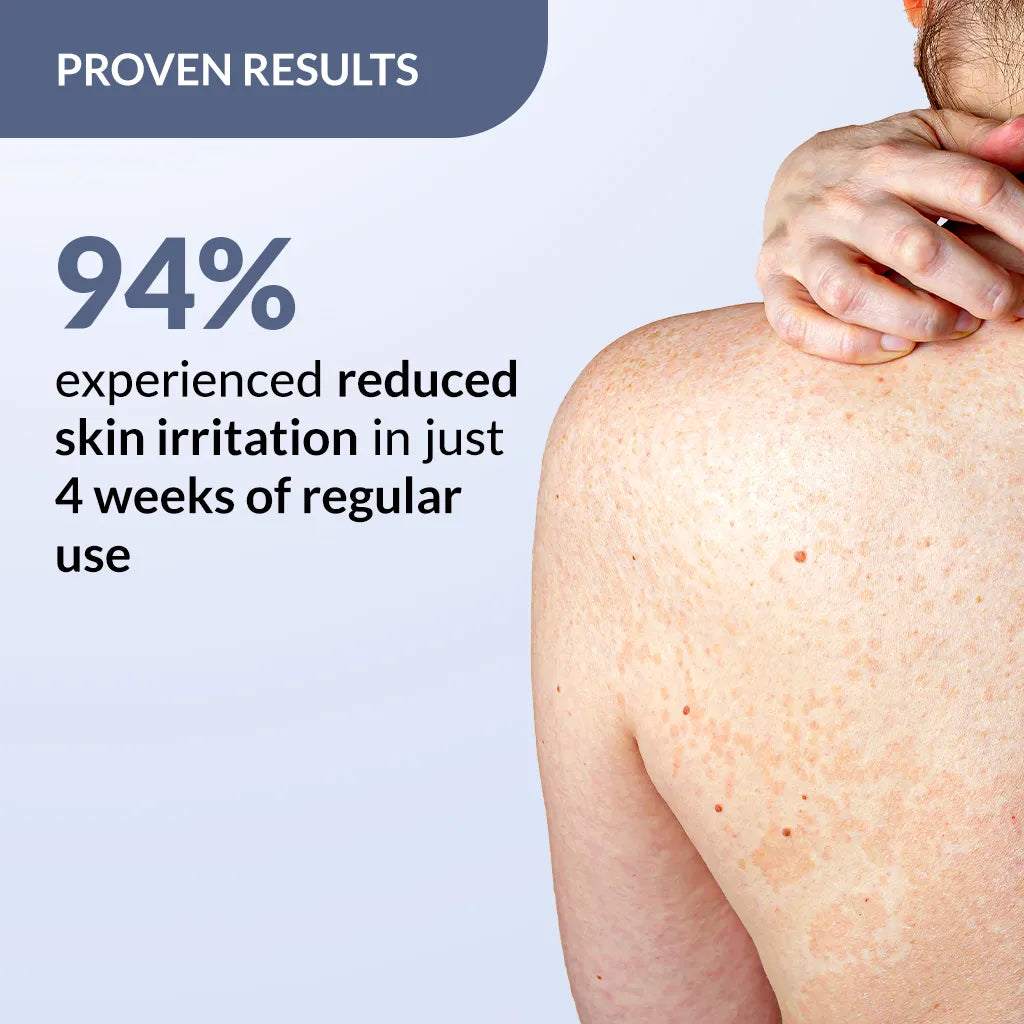 Salyzap Spray for Body Acne
