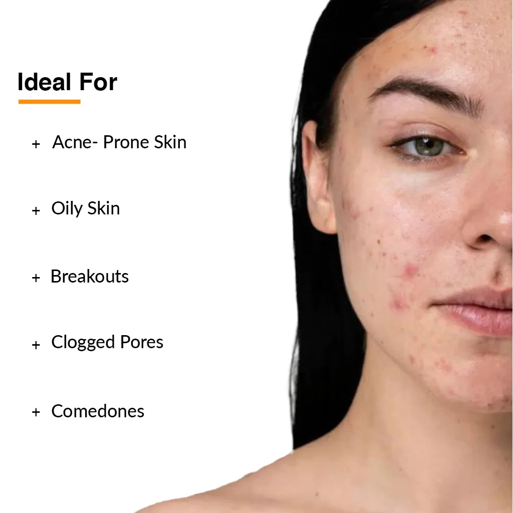 2% Salicylic acid + 4% Aloe Vera, Salyzap Daily Face Cleanser for Acne Prone Skin