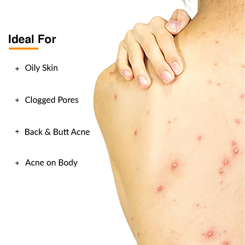 Free Salyzap Acne Body Wash 15ml