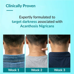 Nigrifix Advance Cream