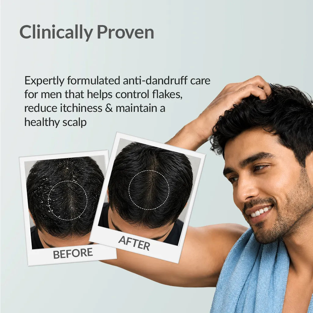FOR MEN Anti-Dandruff Shampoo