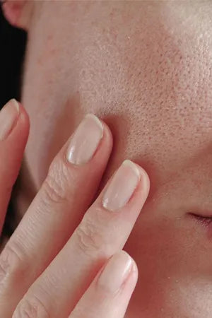 Open Pores