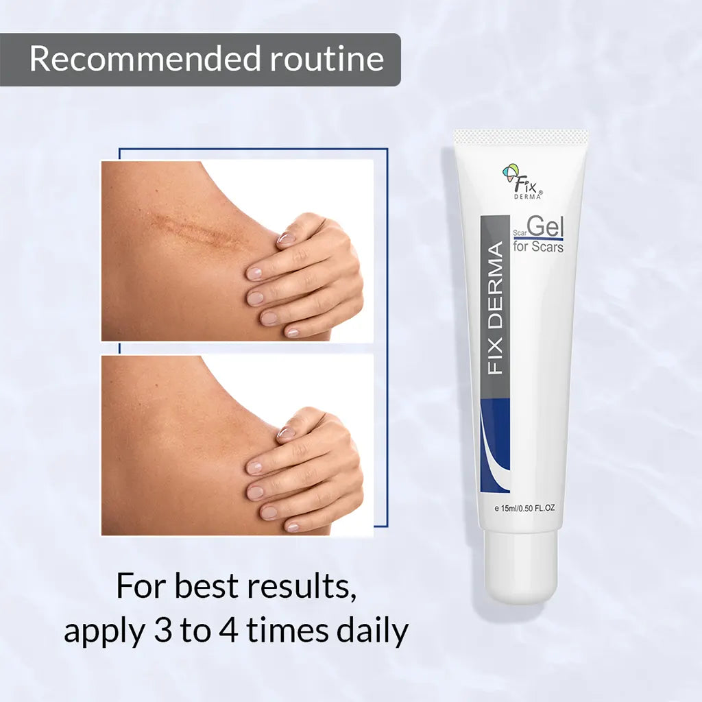 Scar Gel for Scars