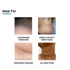 Nigrifix Cream Sample