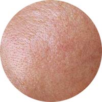 Fixderma Skincare