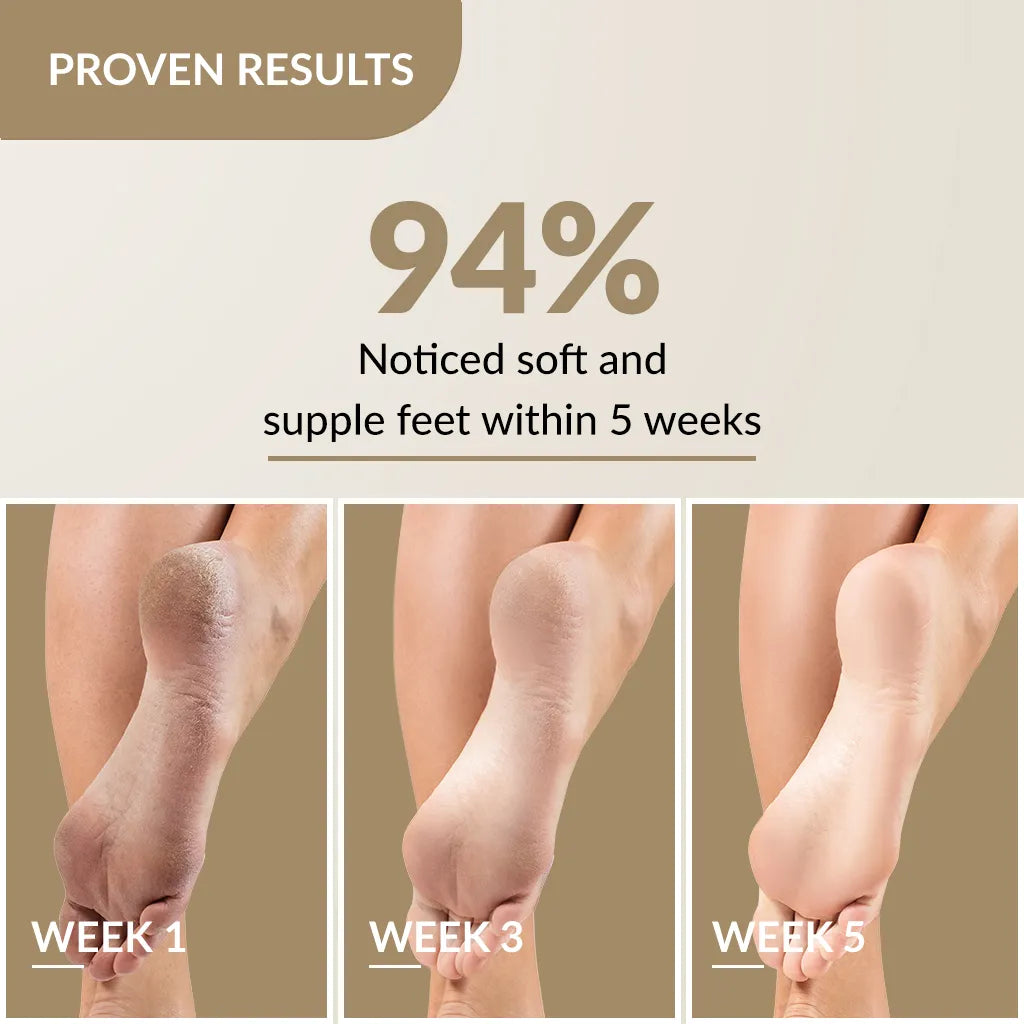 Foobetik Foot Cream 50g For Cracked Heels Rough Feet - Main Image