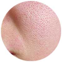 Fixderma Skincare