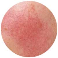 Fixderma Skincare