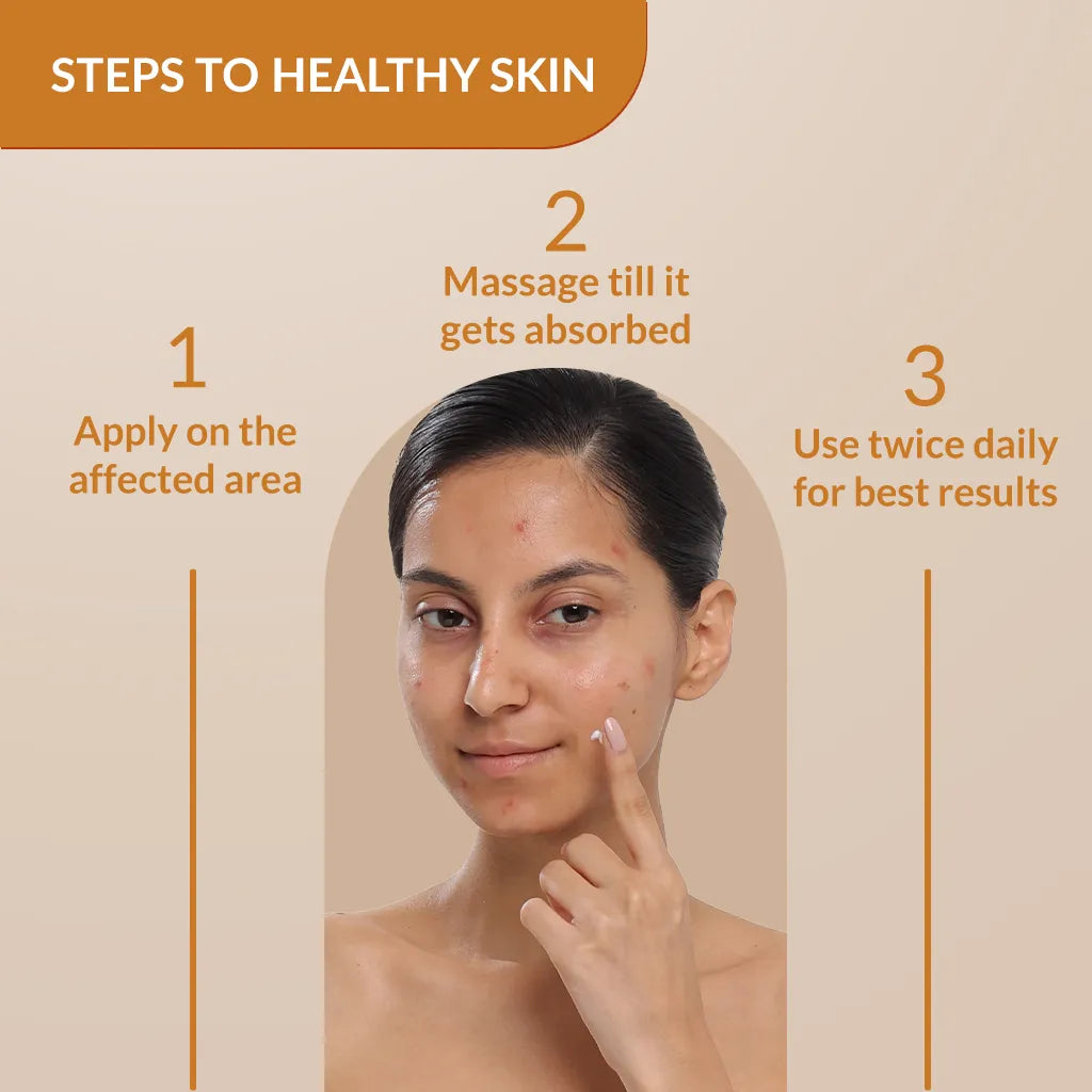 Skarfix-Plus Scar Removal Cream