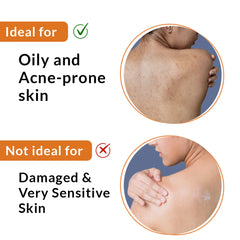 oily acne prone skin care routine
